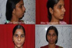 Suraksha Dental