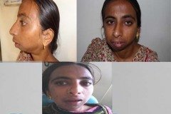 Suraksha Dental