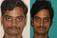Suraksha Dental