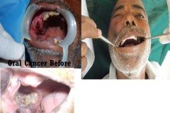 Suraksha Dental