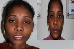 Suraksha Dental
