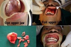 Suraksha Dental