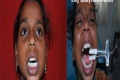 Suraksha Dental