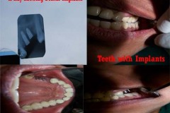 Suraksha Dental