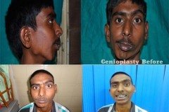 Suraksha Dental